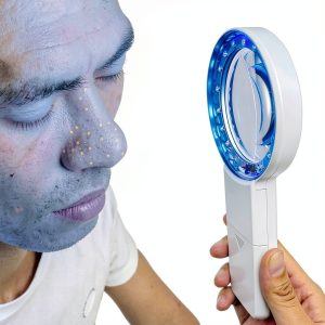 Cordless Wood's Lamp Ringworm Detector 5x Magnifier 16 LED White-0